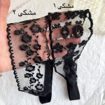 هدبند دانتل - تصویر 4
